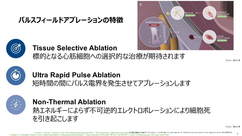 パルスフィールドアブレーションの特徴1