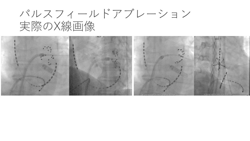 実際のX線画像